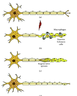 <p>proximity of lesion, extent of damage and the health of the neuron </p>