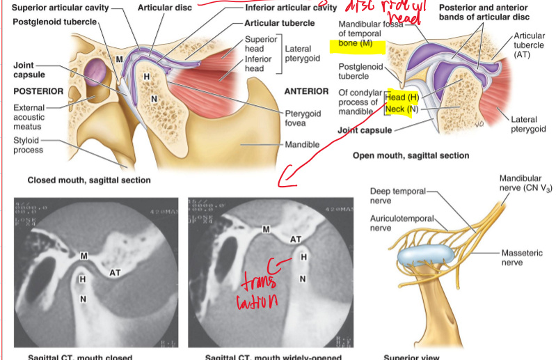 <p>It moves with the head of the mandible as it slides anteriorly during mouth opening and closing.</p>