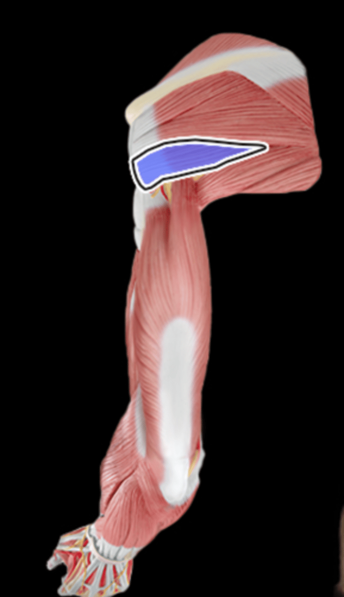 <p>What Muscle Is Highlighted?</p>