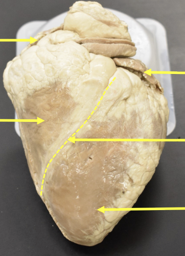 <p>is this the anterior view or posterior view<br>label from top to bottom&nbsp;</p>