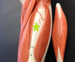 <p>What muscle is this? What is an origin? What is an insertion? What is an action?</p>