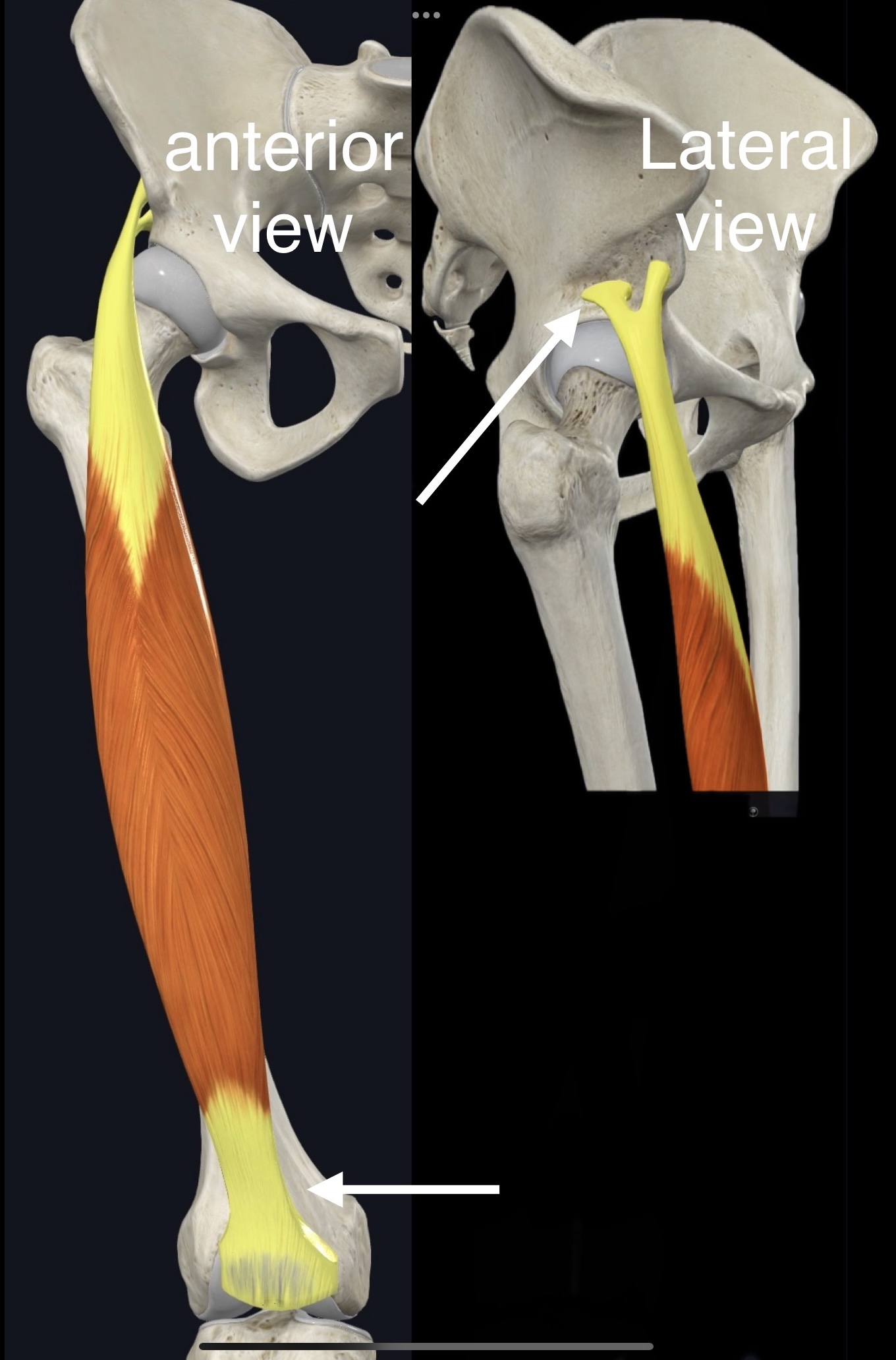 <p>Name the muscle, origin and insertion</p>