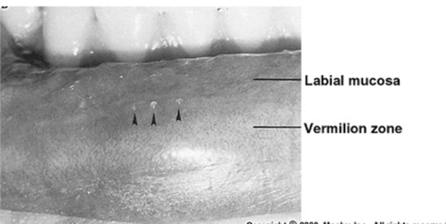 <p>minor mucous glands and deep portions contain obicularis oris muscle fibers</p>