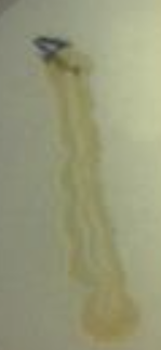 <p>Is this a positive or negative&nbsp;Protein Hydrolysis (Skim milk agar) test?</p>