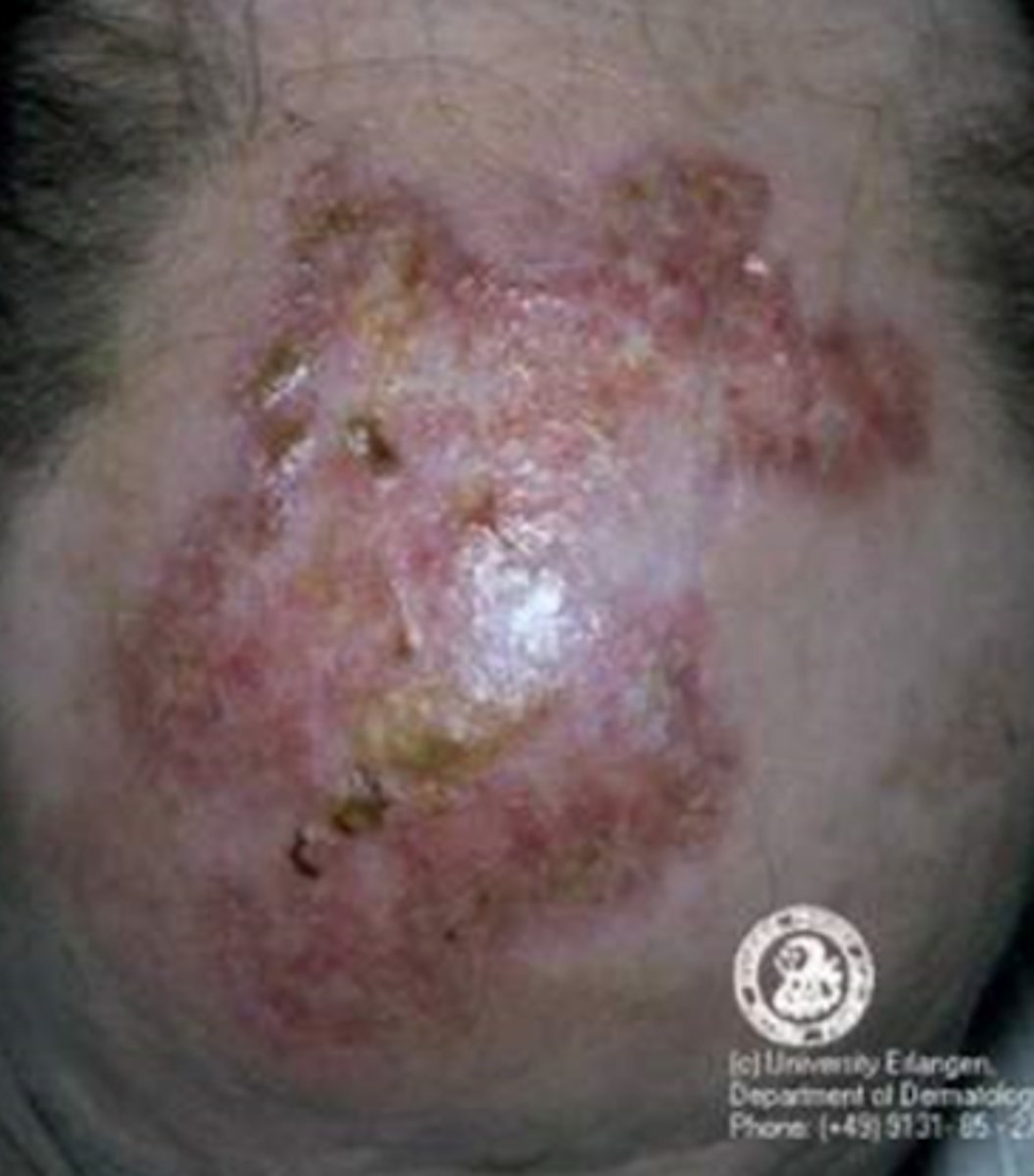 <p>What is the diagnosis?</p>