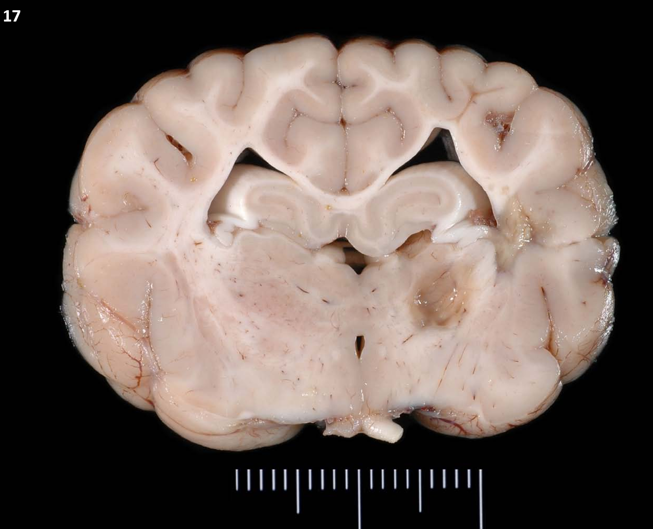 <p>17.<span>&nbsp; </span>Tissue from a dog.<span>&nbsp;&nbsp; </span>The most likely breed of this individual is?</p><ol type="a"><li><p>Maltese</p></li><li><p>Chihuahua</p></li><li><p>Yorkie </p></li><li><p>Pug</p></li></ol><p></p>