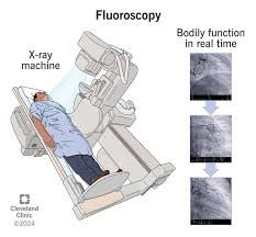 <p>x-ray tube is below patient and the screen is above which once hit by xray radiation is then converted over to a digital copy creating a video like real time result.</p>