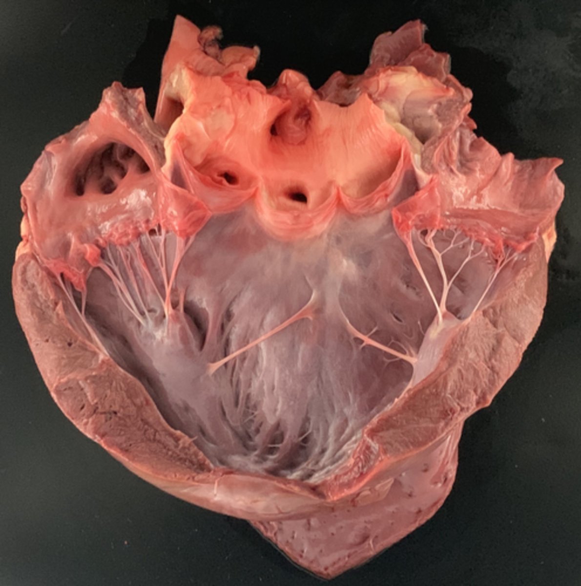 <p>What is the weight of a normal heart?</p>