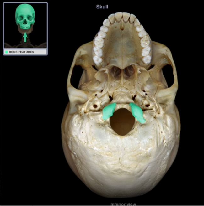 <p>Occipital Condyles </p>