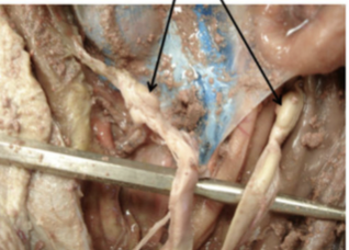 <p>#8 both lines</p>