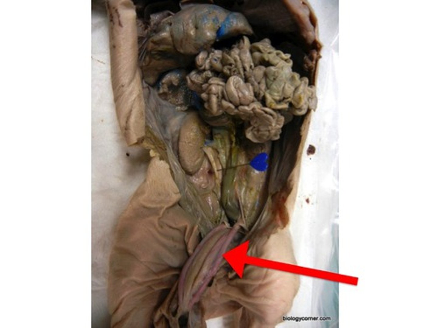 <p>Brings DEOXYGENATED blood and nutrients from fetus to mother.</p>