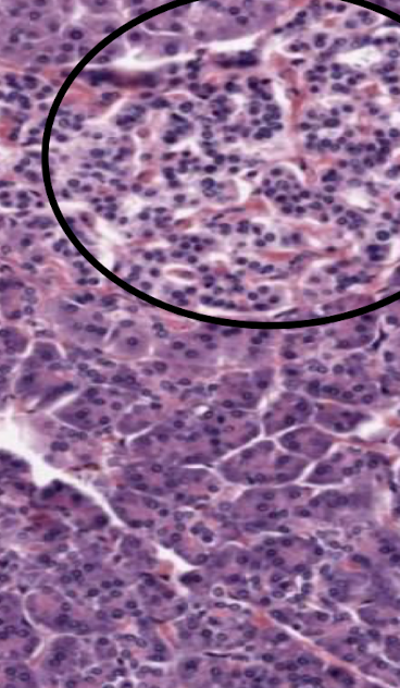 <p>Bottom portion of the image. Classify the tissue.</p>