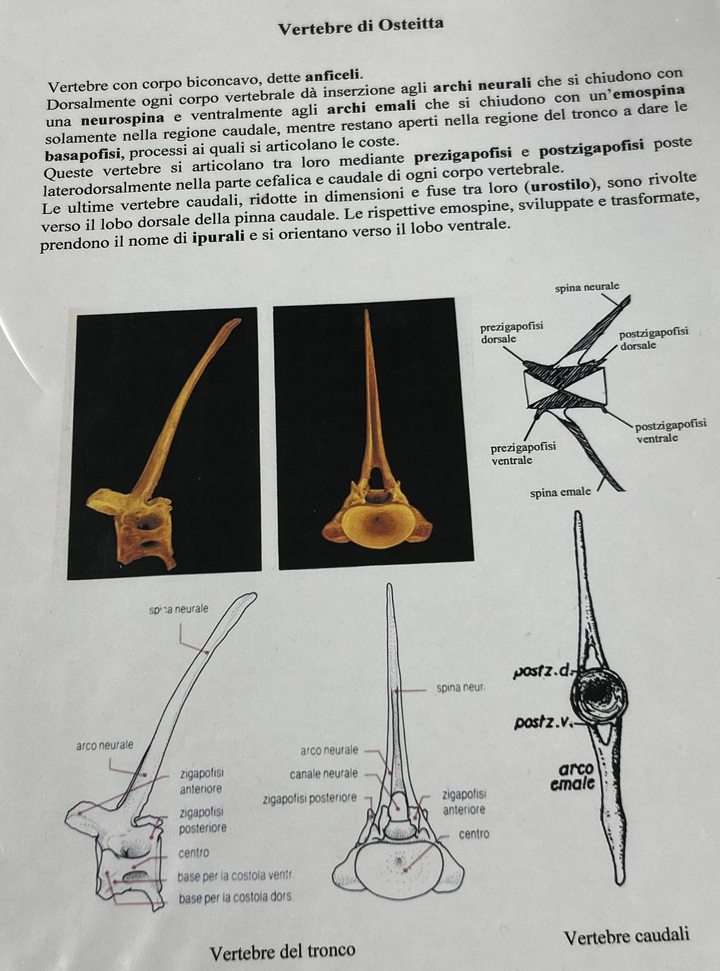 <p>Vertebre osteitta</p>