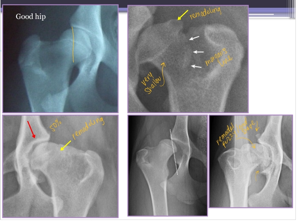 <ul><li><p><span style="background-color: transparent; color: red;"><strong><u><span>VD most useful</span></u></strong></span></p></li><li><p><span style="background-color: transparent; color: red;"><strong><u><span>Want >50% acetabular coverage!</span></u></strong></span></p></li><li><p><span style="background-color: transparent;"><strong><span>Rads:</span></strong><span> Bone shape, remodeling, osteophytosis(neck), enthesiophytosis (Morgan’s line), laxity</span></span></p><ul><li><p><span style="background-color: transparent;"><span>Do not treat the radiograph!</span></span></p></li><li><p><span style="background-color: transparent;"><strong><span>CT + MRI:</span></strong><span> not useful and expensive</span></span></p></li></ul></li><li><p><span style="background-color: transparent;"><strong><span>Arthrocentesis: </span></strong></span><span style="background-color: transparent; color: red;"><span>Rule out infection or neoplasia</span></span></p></li><li><p><span style="background-color: transparent;"><strong><span>Arthroscopy: </span></strong><span>Articular lesion evaluation, prior to TPO</span></span></p><ul><li><p><span style="background-color: transparent;"><span>Rarely needed</span></span></p></li></ul></li></ul><p></p>