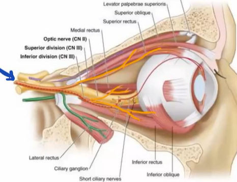 <p>CN III - motor</p><p>o: midbrain</p><p>p: superior orbital fissure</p><p>f: 4/6 eye movement mm → superior rectus, inferior rectus, medial rectus, inferior oblique</p><p></p><p>*parasympathetic innervation</p>