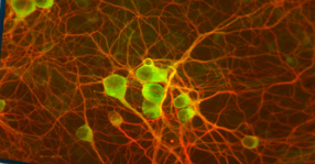 <p>What neurons are pictured?</p>