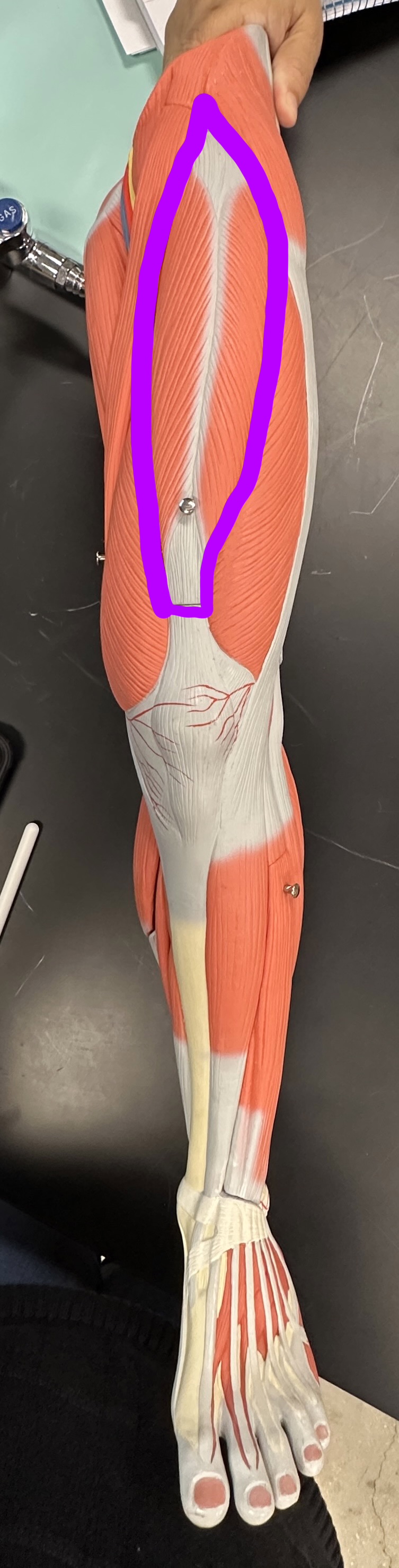 <p>What is the highlighted structure (deep to rectus femoris)</p>