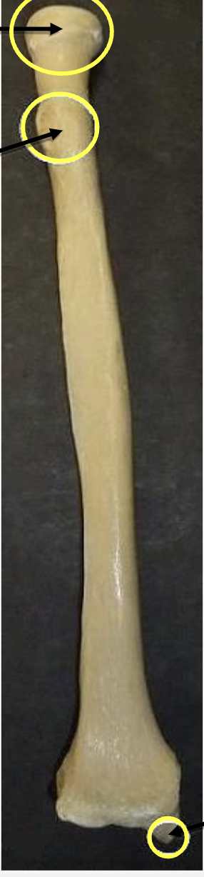 <p>Identify this bone </p>