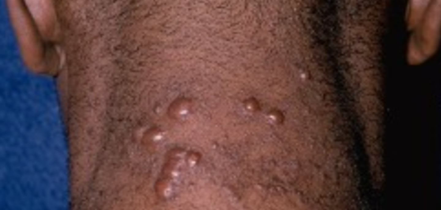 <p>What is the diagnosis?</p>