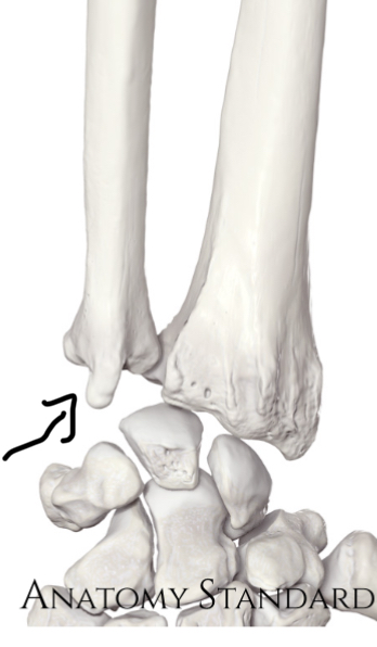 <p>Hoe heet dit deel?</p>