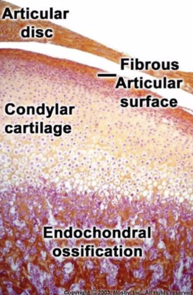 <p>what is the fibrous material on the surface of the TMJ</p>