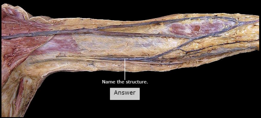 <p>What vein is this</p>