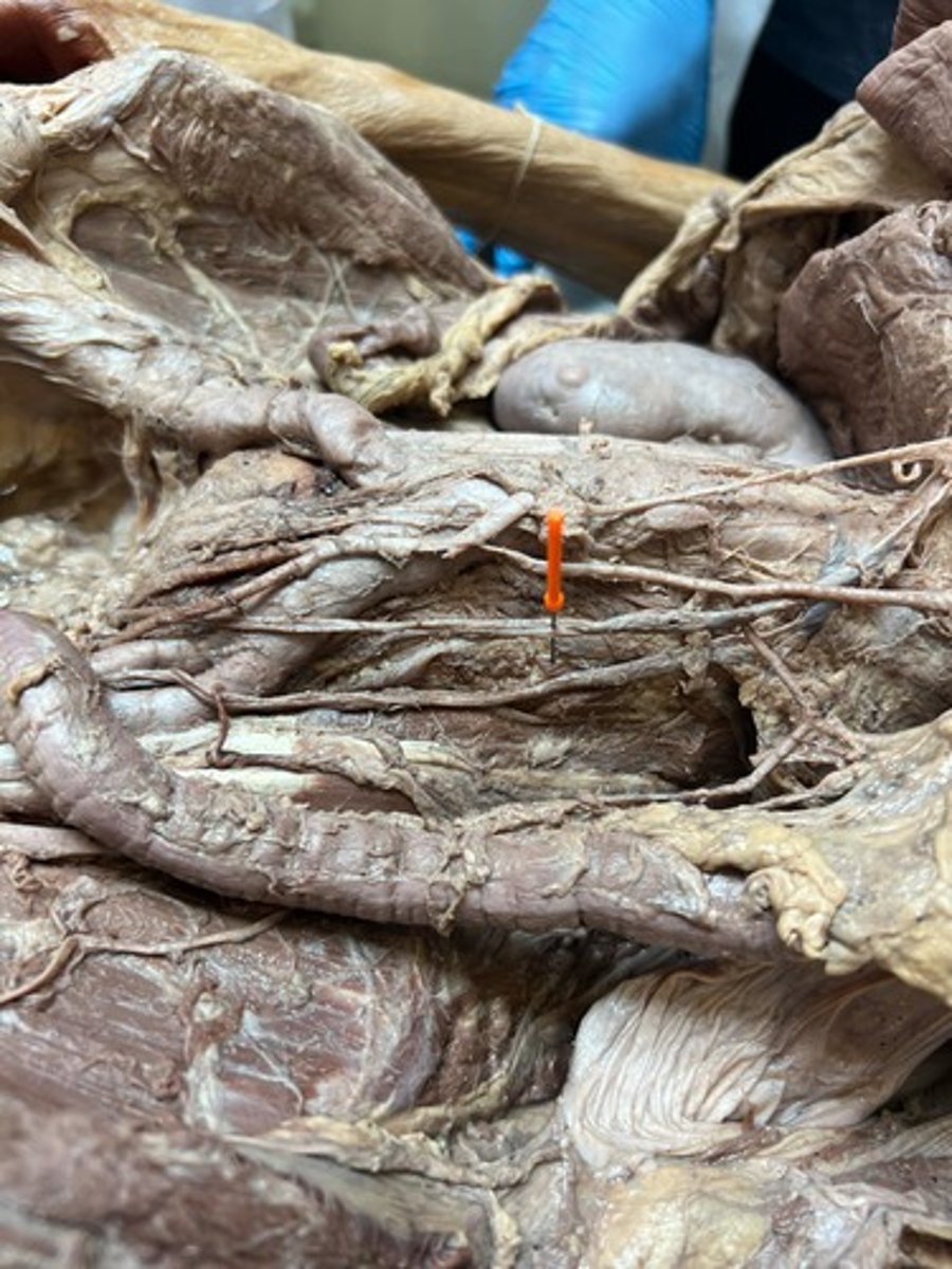 <p>testicular/ ovarian artery</p>
