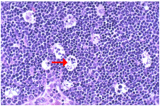 <ol><li><p>Identify the type of cell death</p></li></ol><p></p>