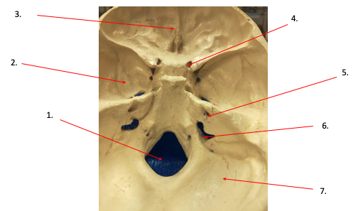 <p>What area of the skull is #5?</p>