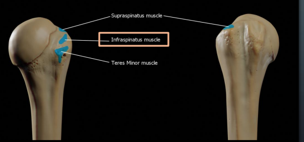 <p>Greater tubercle of the humerus</p>