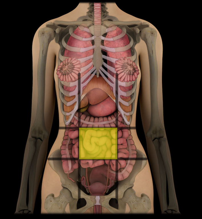 term image