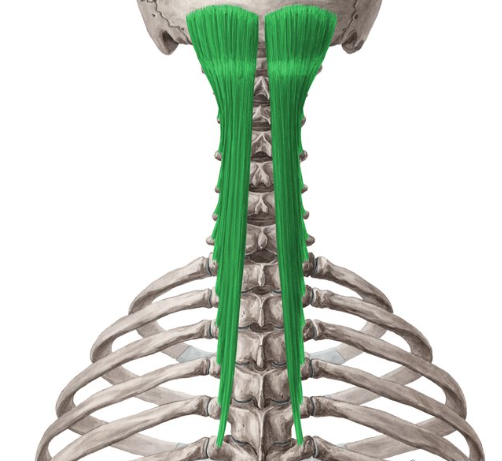 <p>What muscle is this?</p>