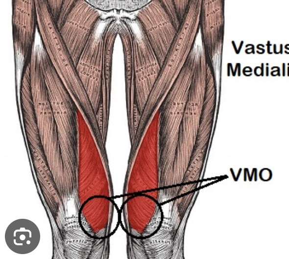 <p>Anterior View </p>
