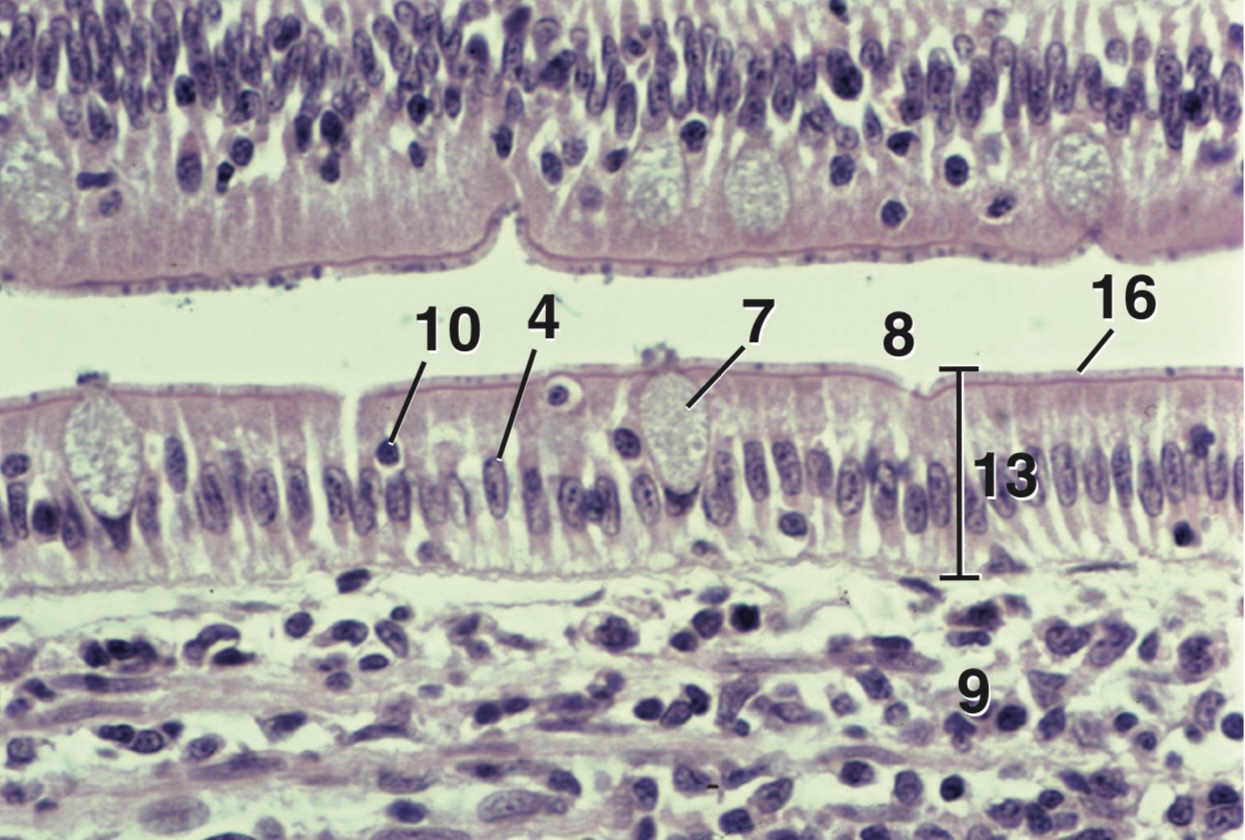 <p>Where can you see this type of epithelium?</p>