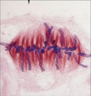 <p>what stage of mitosis?</p>