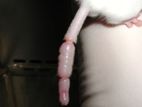 <p><span>What is the most likely cause for this condition shown in the image below?</span></p>