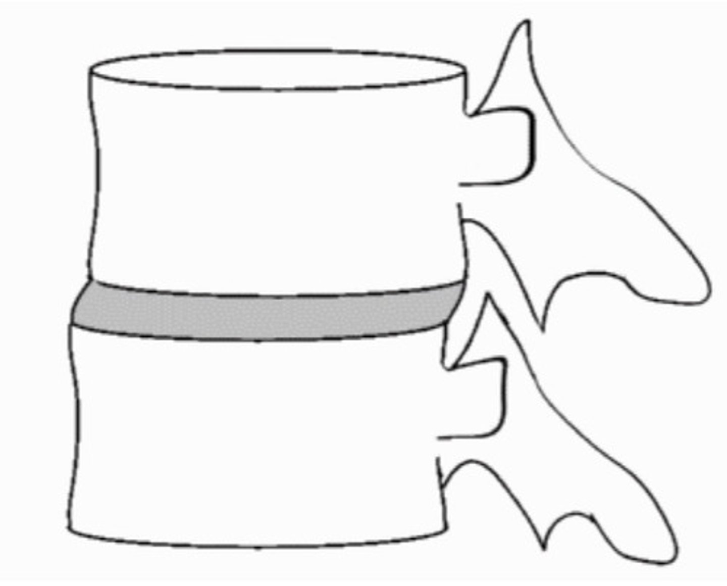 <p>+Z translation restriction (motion listing)</p>