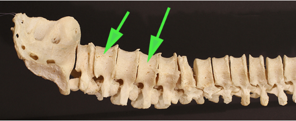 <p>Which type of vertebra are the green arrows indicating?</p>