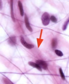 <p>Collegen fiber</p>