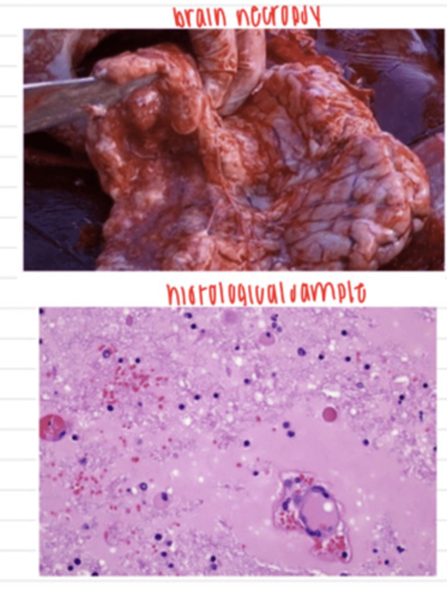 <p>a man is concerned about his horse because it has been depressed, circling, weak, staggering, and cannot swallow his food. unfortunately, the horse dies before the vet can treat it, but the vet does a necropsy and finds areas of grey-brown malacia in the brain. he takes a sample and histologically observes liquefactive necrosis, congestion, and hemorrhages in the white matter of the cerebrum.</p><p>what is the diagnosis?</p>