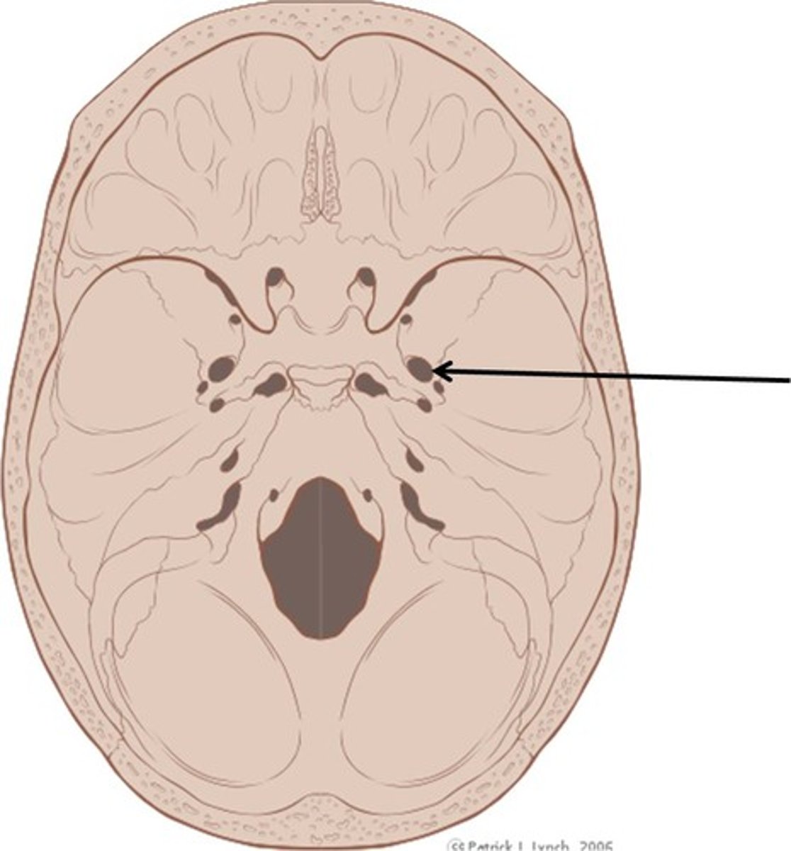 <p>opening posterior to the sella turcica that allows passage of a branch of the fifth cranial nerve</p>