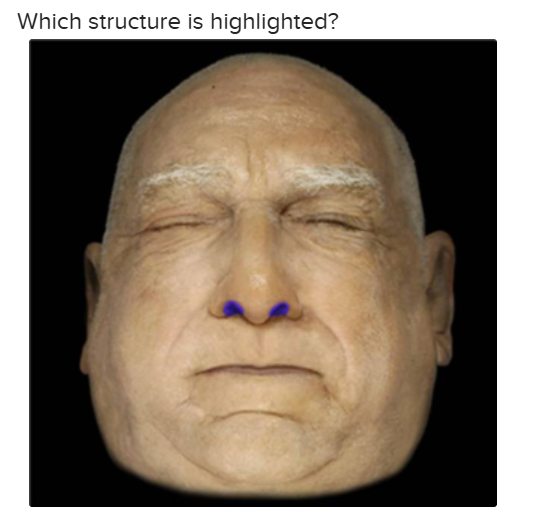 <p>The structure highlighted is: </p>