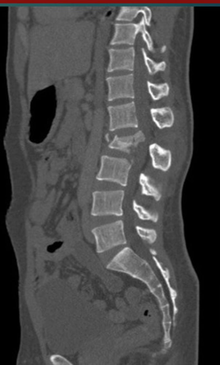 <p>What abnormality is this?</p>
