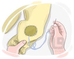 <p><span>to repair or heal.</span><br></p>