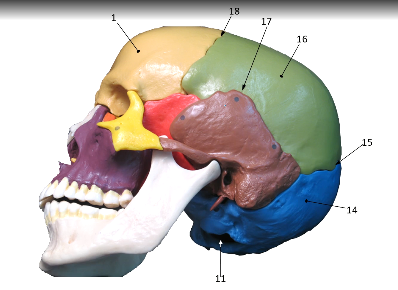<p>Coronal Suture</p>