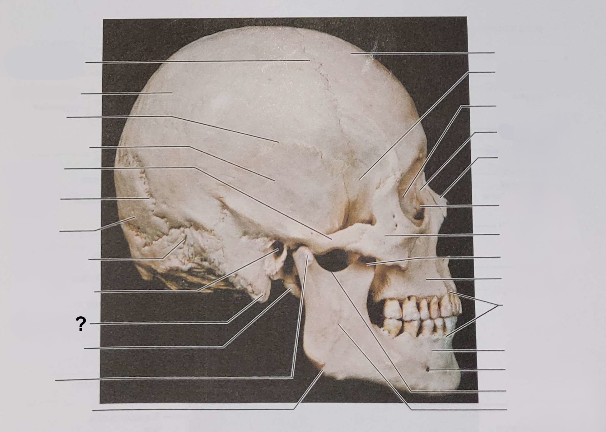 <p>Name the indicated structure</p>