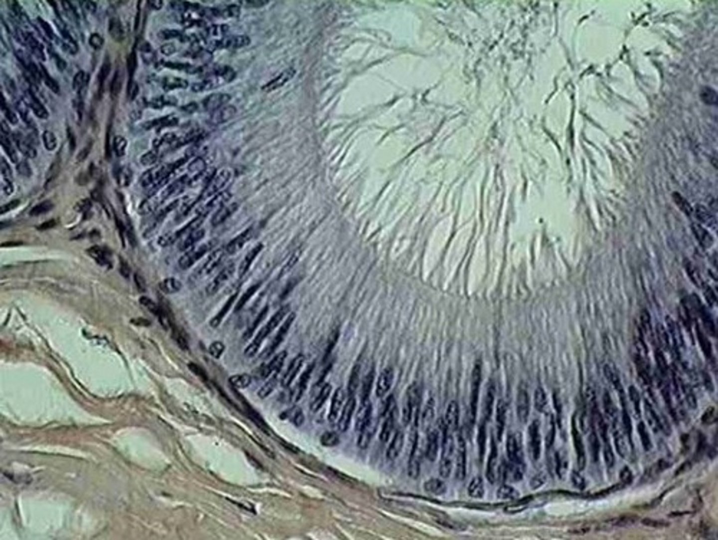 <p>Lining of Epididymis</p>