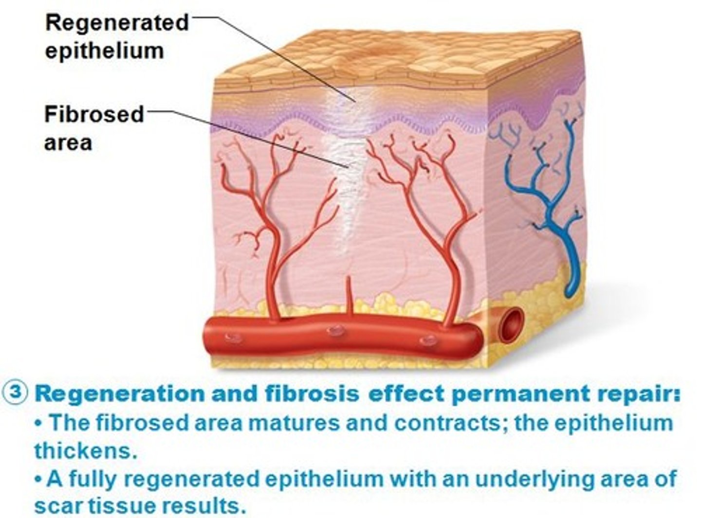 <p>replacement of destroyed tissue by the same kind of cells</p>