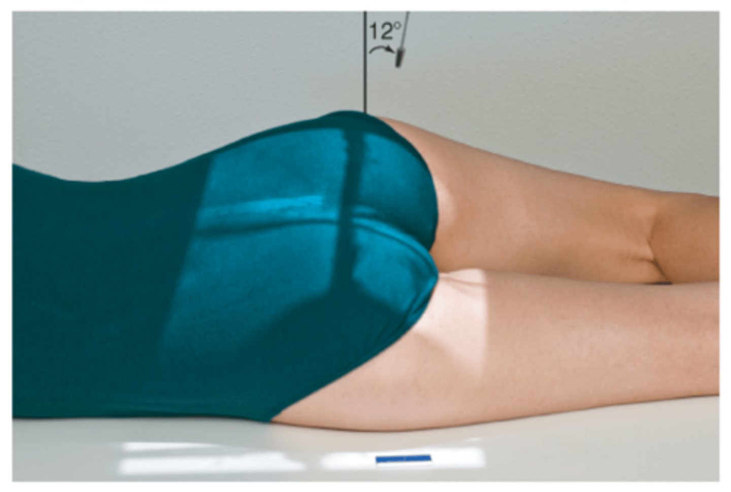 <p>angled 12 degrees cephalic and directed 1 inch above greater trochanter/2 inches lateral to the midsagittal plane</p>