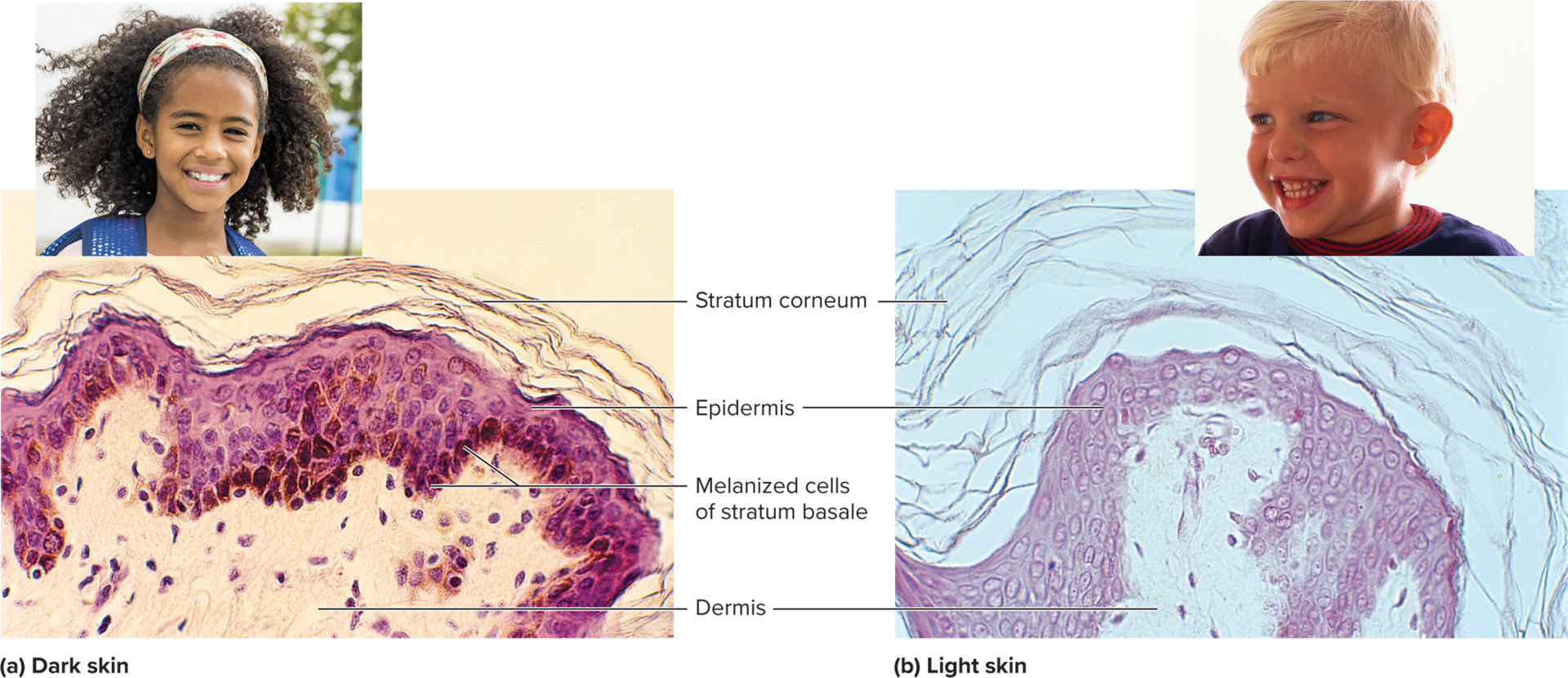 <p>where is most of melanin located?</p>
